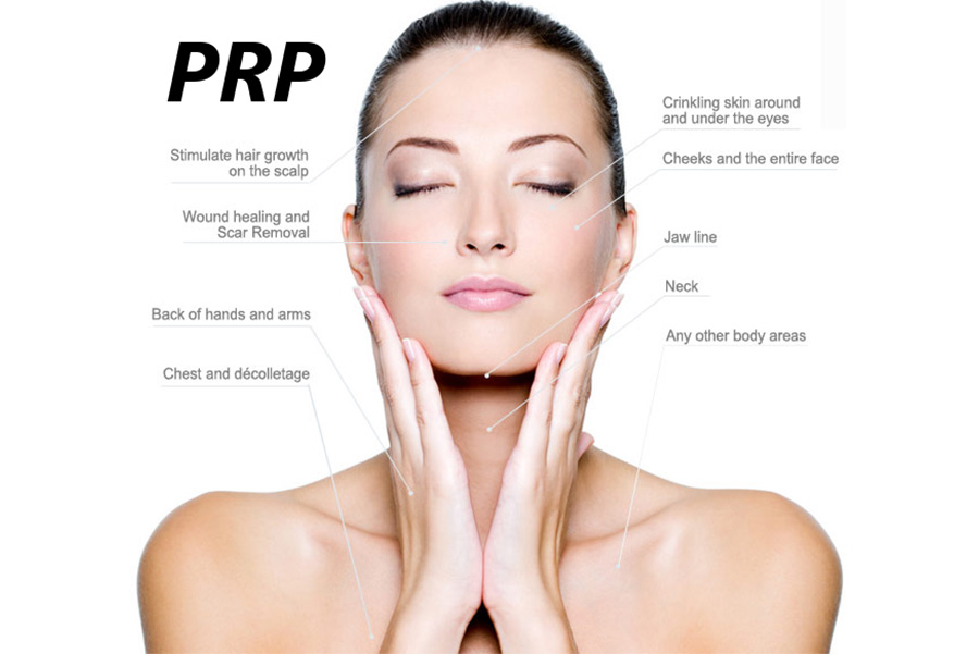 PRP treatment wellington