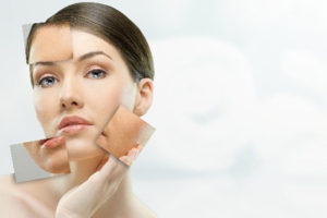 Touching your face often can cause acne – Myth or Fact?