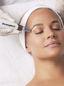 Dermal Needling with Dermapen, Wellington