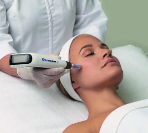 Why Dermal Needling Is for You, Not Just for Celebrities