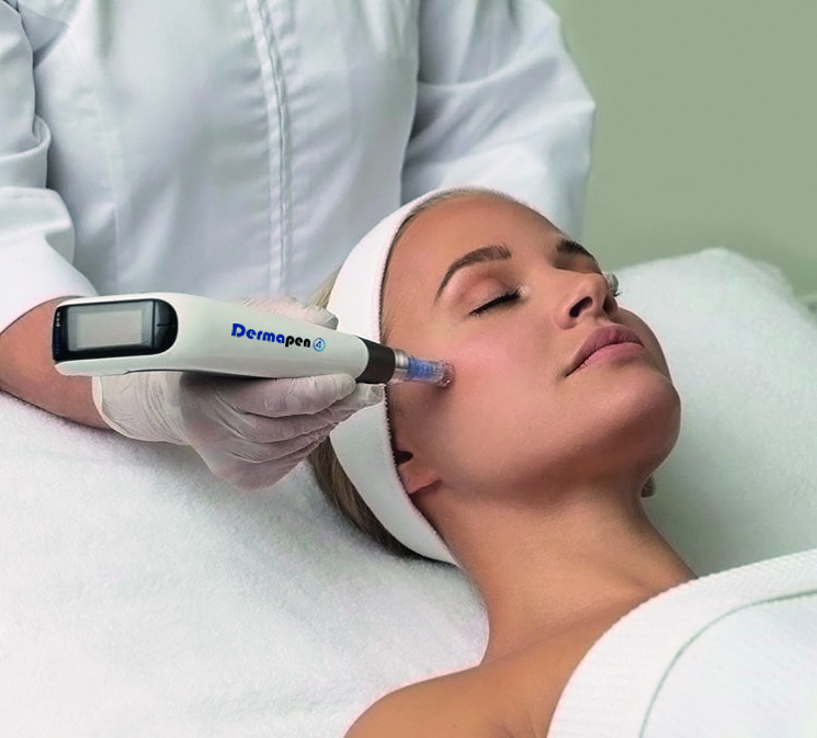 Dermal Needling with Dermapen, Accent on Skin, Wellington, NZ