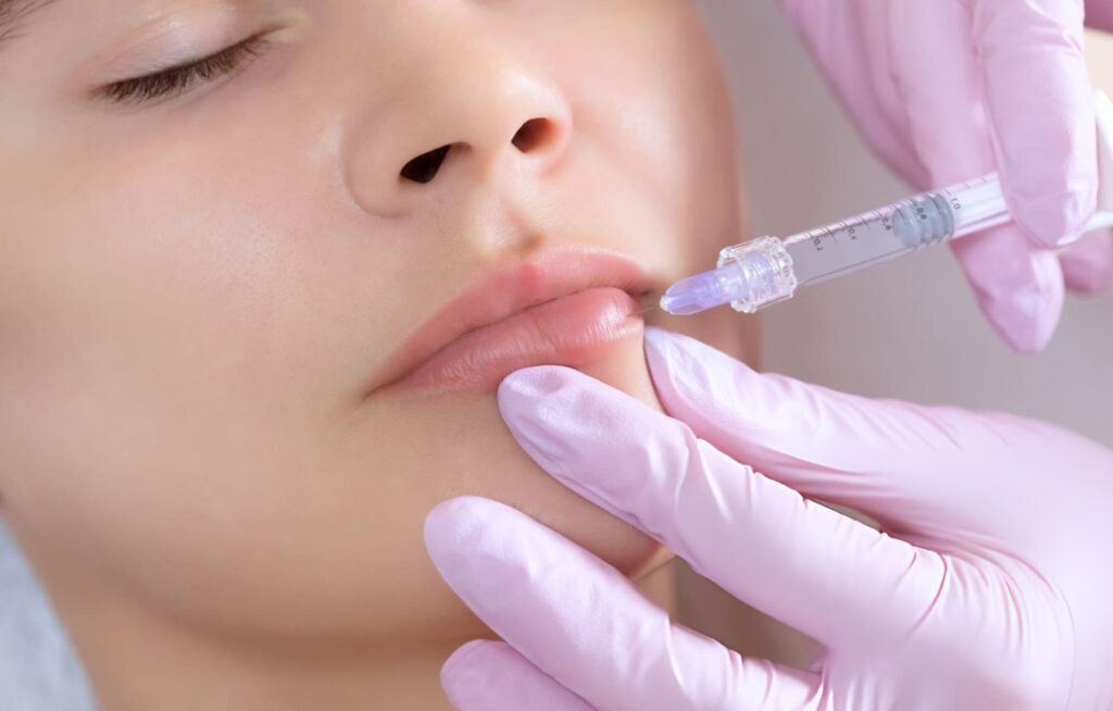 Lip Filler Treatment