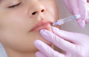 How Much Lip Filler Should You Get? A Complete Guide To Selecting The Right Amount
