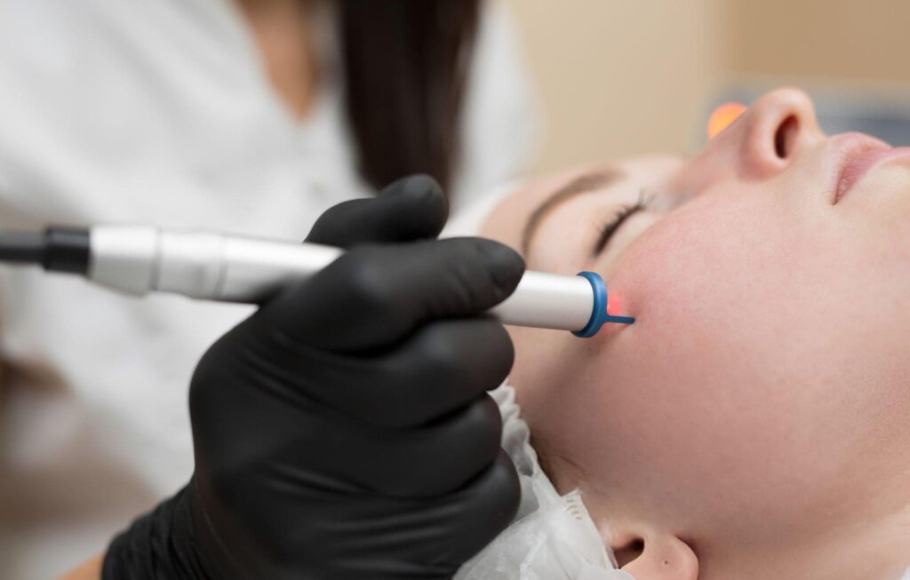 CryoPen Treatment