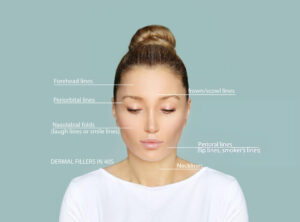 PRP treatment wellington