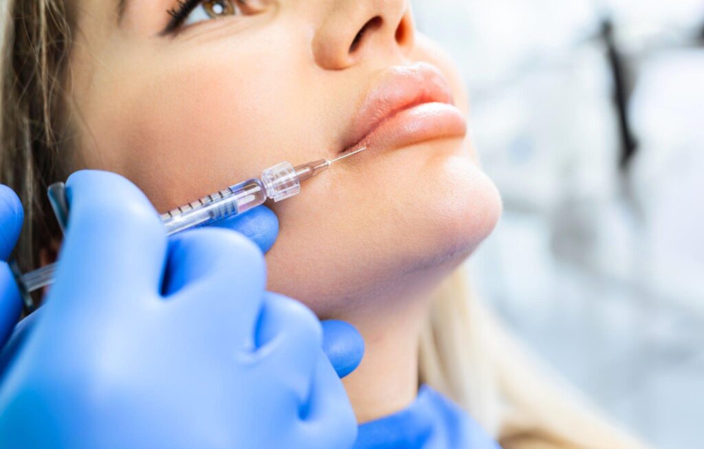 Lip Fillers